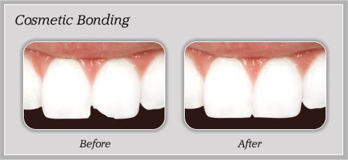 Before and After Dental Treatment