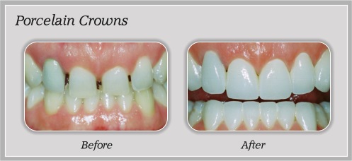 Before and After Dental Treatment